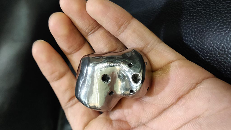 stampa 3D titanio osso del piede