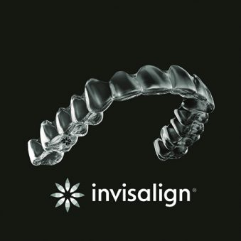 ortodonzia Align 3D Systems additivo