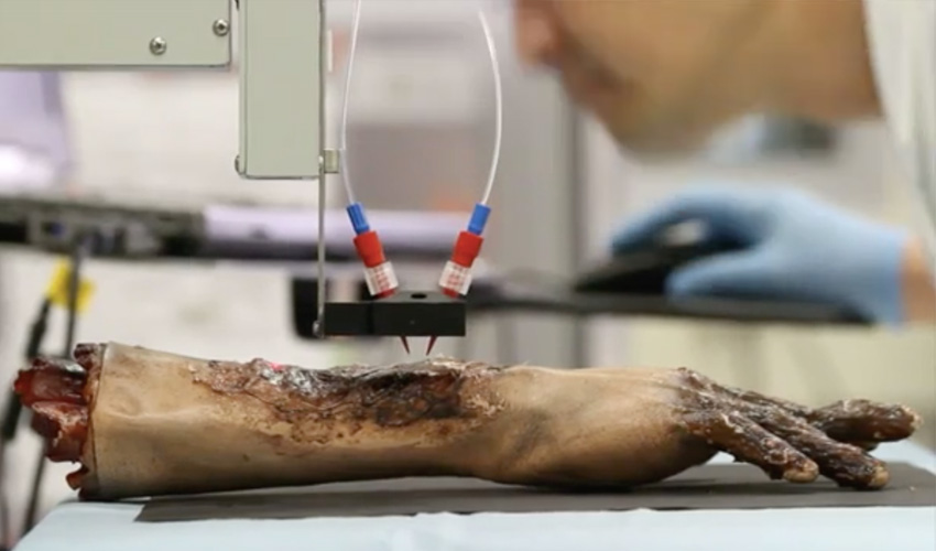 bioprinter_stampa 3D pelle medicina rigenerativa