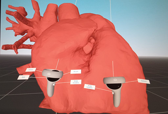Cardiochirurgia Padova realtà virtuale 3D