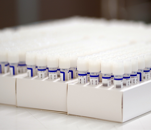 Omron-robot-scara-sistemi-visione-movimentazione-provette-etichettatura-Macco-Werfen